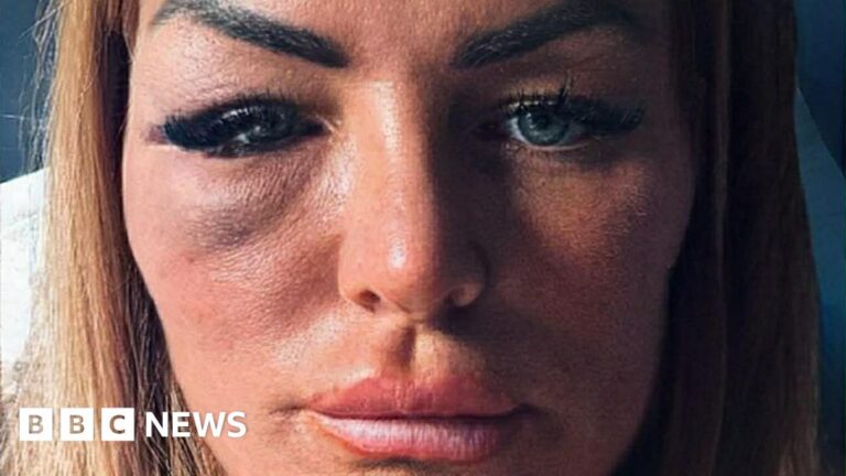 Golpe devastador: mujer agredida tras rechazar a peleador de MMA golpe-devastador-mujer-agredida-tras-rec